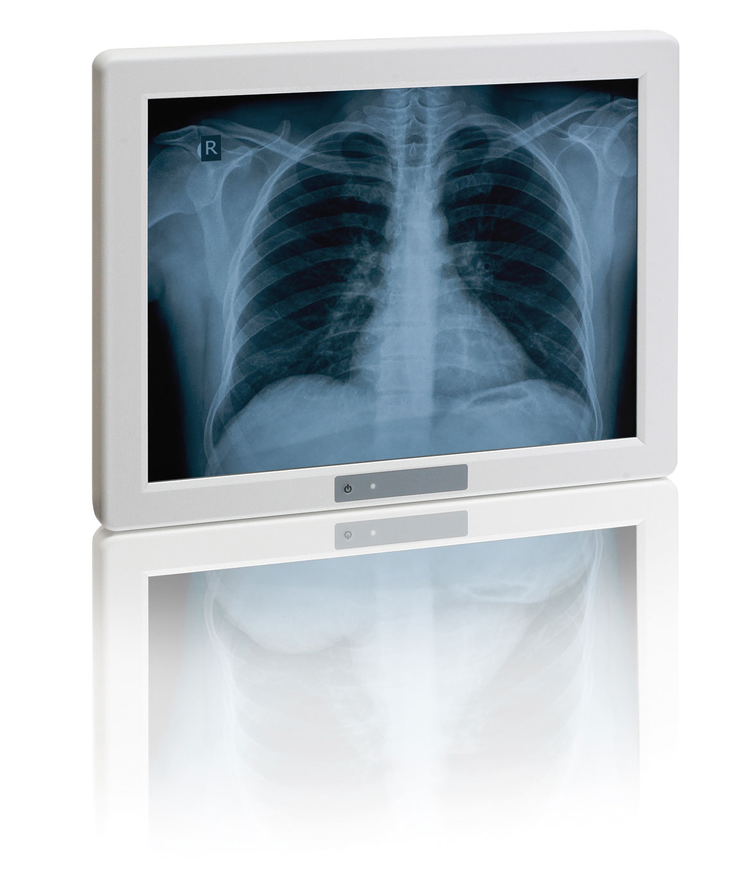 Medi Client IIA 150 (EOL)